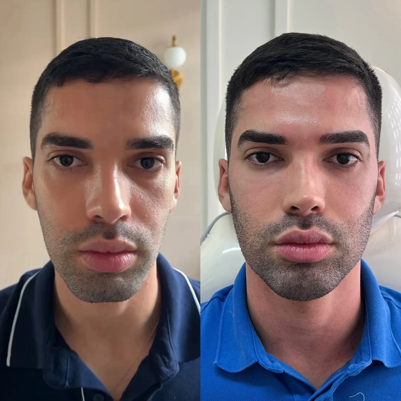 Antes e depois — resultado 02