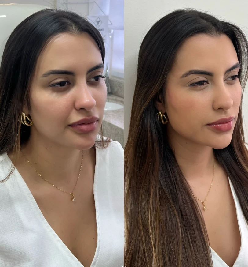 Antes e depois — resultado 03